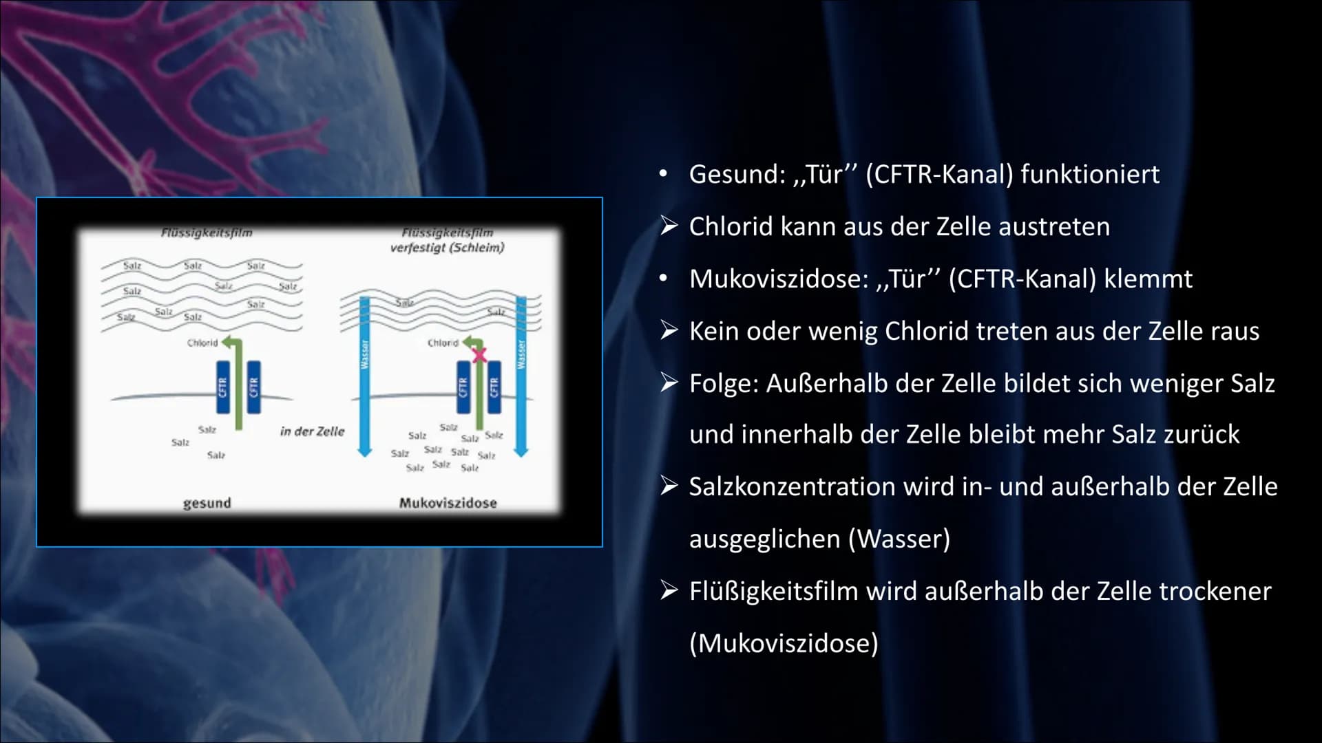 Mukoviszidose # Inhalt

• Was ist Mukoviszidose?
• Ursachen
• Genetische Vererbung
• Symptome
• Diagnoseverfahren
• Behandlungsmöglichkeiten