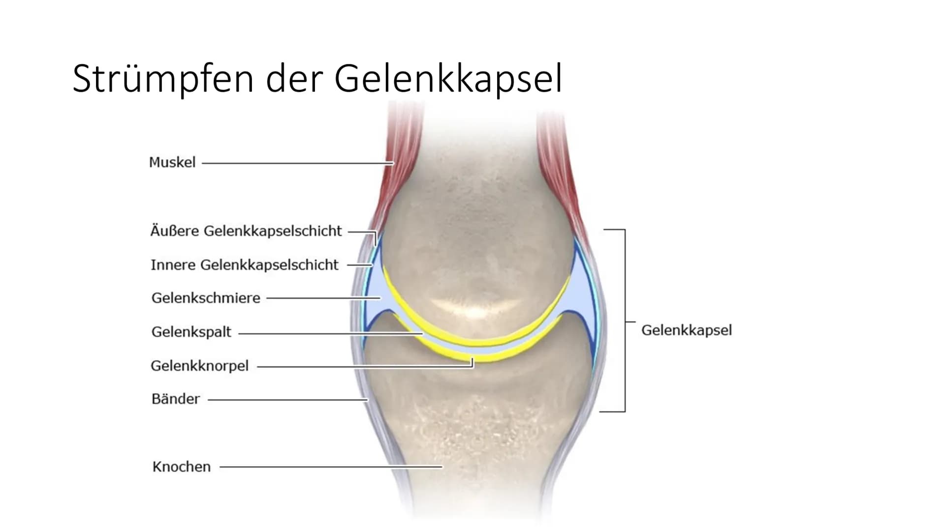 # KONTRAKTURPROPHYLAXE Gliederung

*   Thema/Problem
*   Ursachen und Risikofaktoren
*   Symptome und Auswirkungen
*   Maßnahmen
*   Übungen