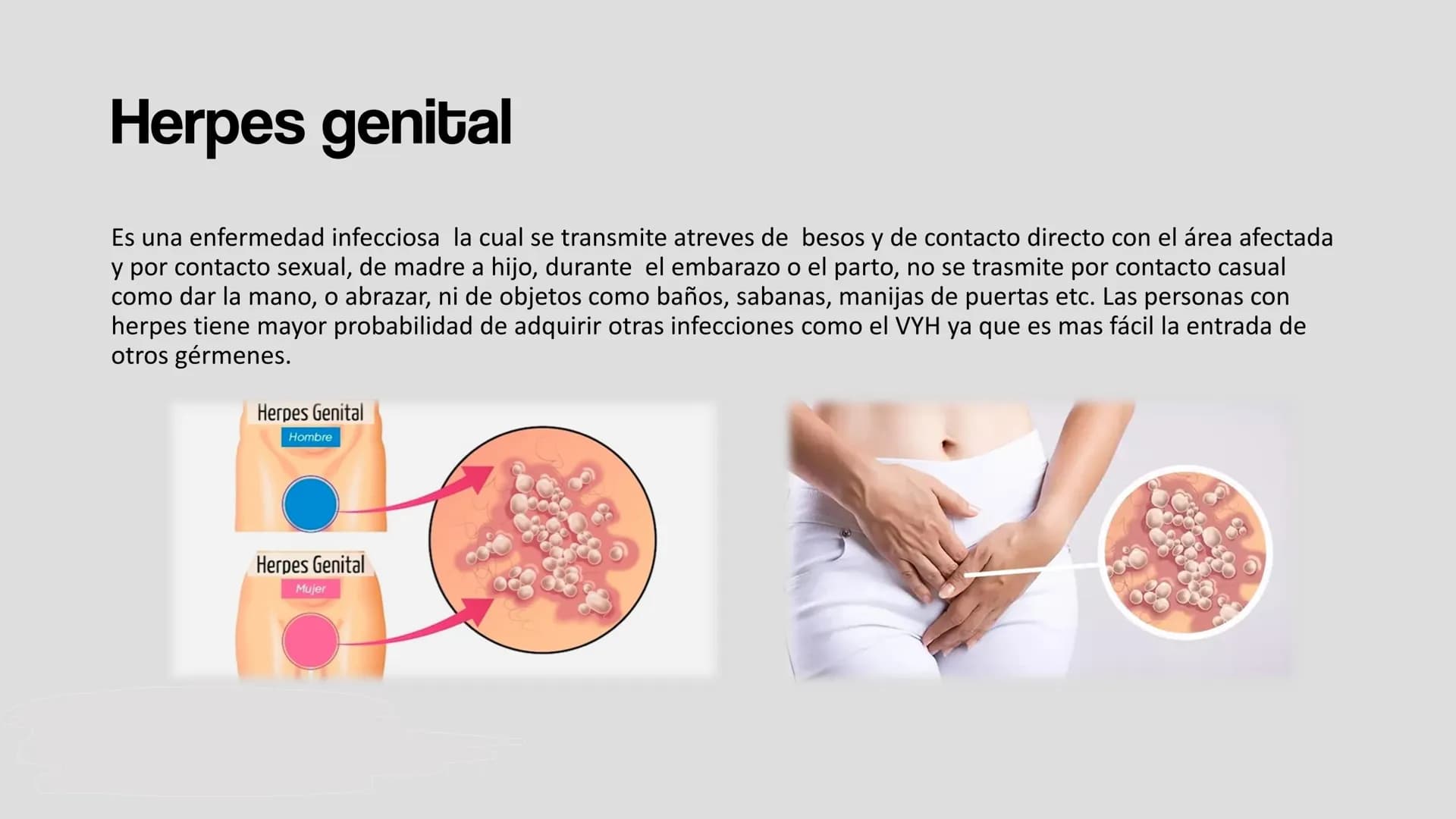 # HERPES GENITAL # Herpes genital

Es una enfermedad infecciosa la cual se transmite atreves de besos y de contacto directo con el área afec
