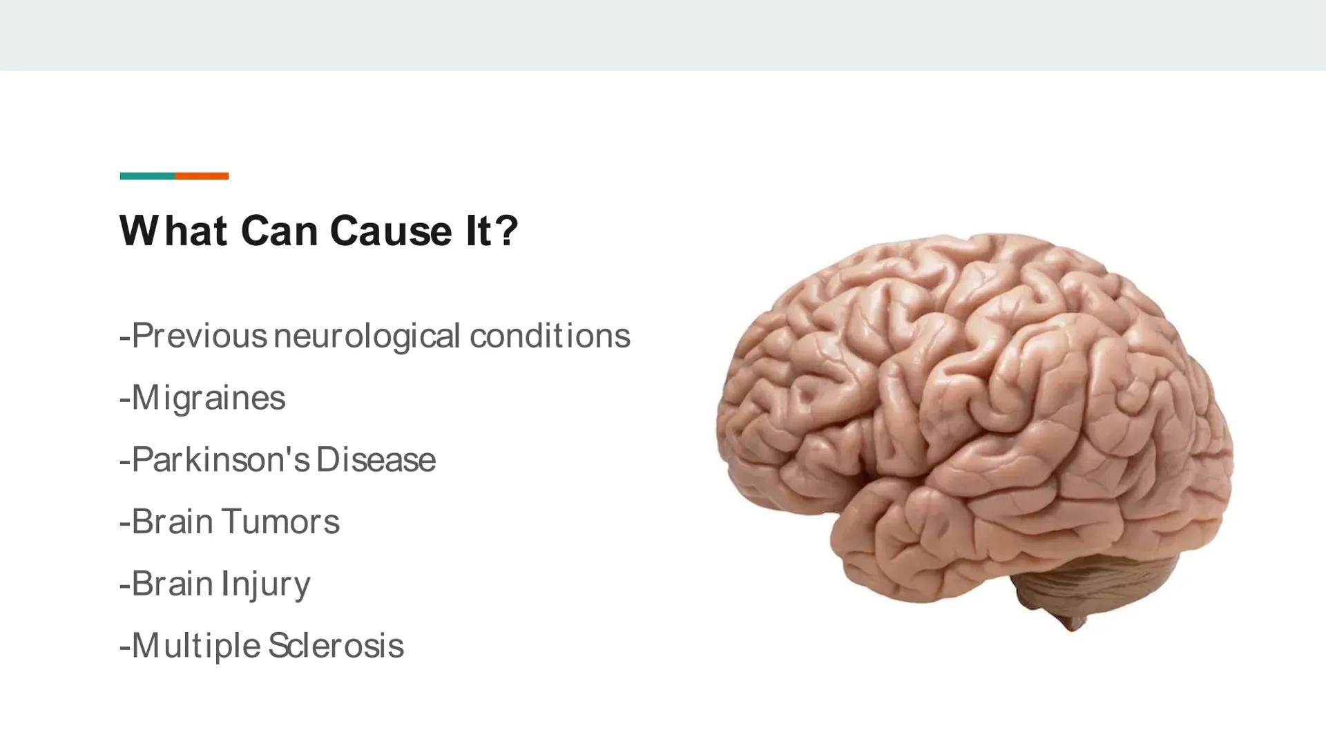 ## The Cotard Delusion What is the Cotard Delusion?
A condition where individuals
deny that they have a certain
body part, or deny that they