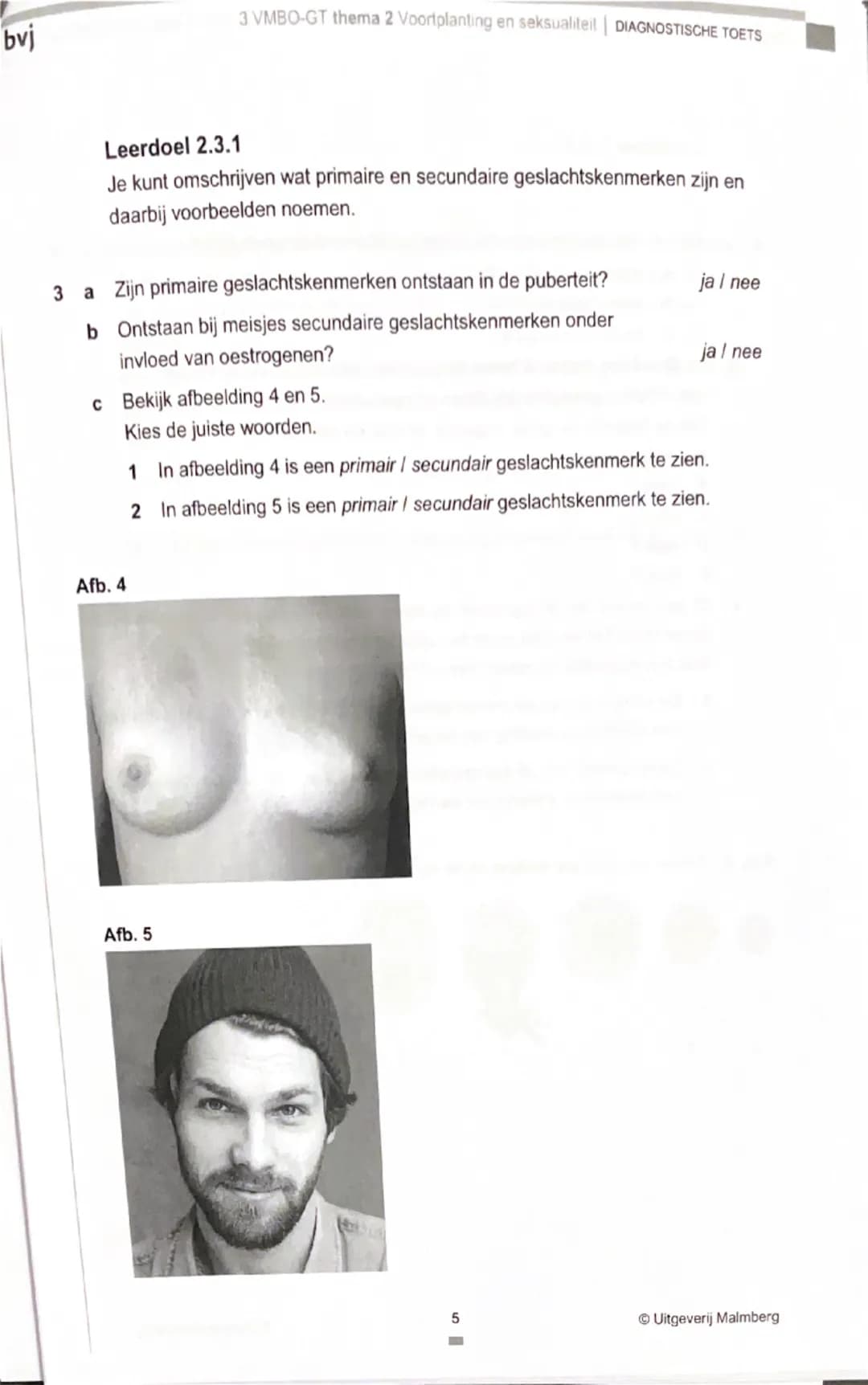 bvj
3 VMBO-GT thema 2 Voortplanting en seksualiteit | DIAGNOSTISCHE TOETS

Je kunt de opdrachten van de Diagnostische toets maken om je voor