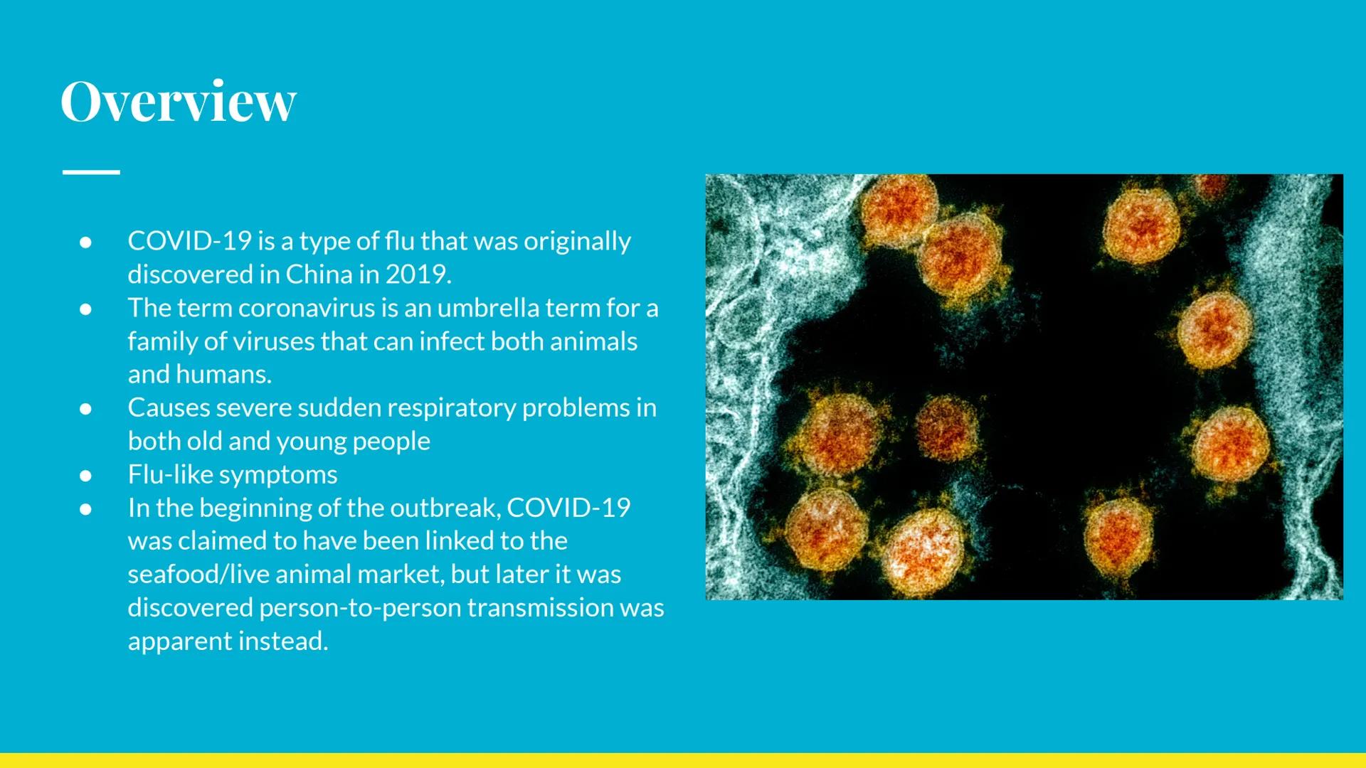 # COVID-19

Kai Davison # Overview

- COVID-19 is a type of flu that was originally
discovered in China in 2019.
- The term coronavirus is a