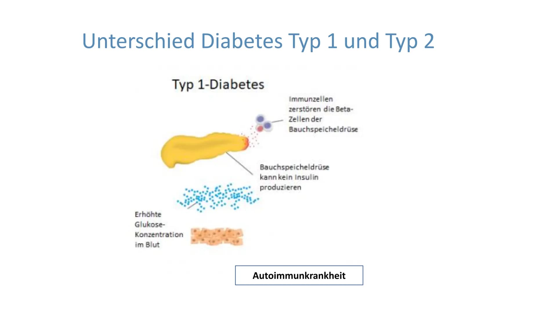 # "Altersdiabetes"
im Jugendalter

Inwiefern ist die
Erkrankung heilbar? # Gliederung

Was ist Diabetes Typ 2?

Maßnahmen und Therapien

*  