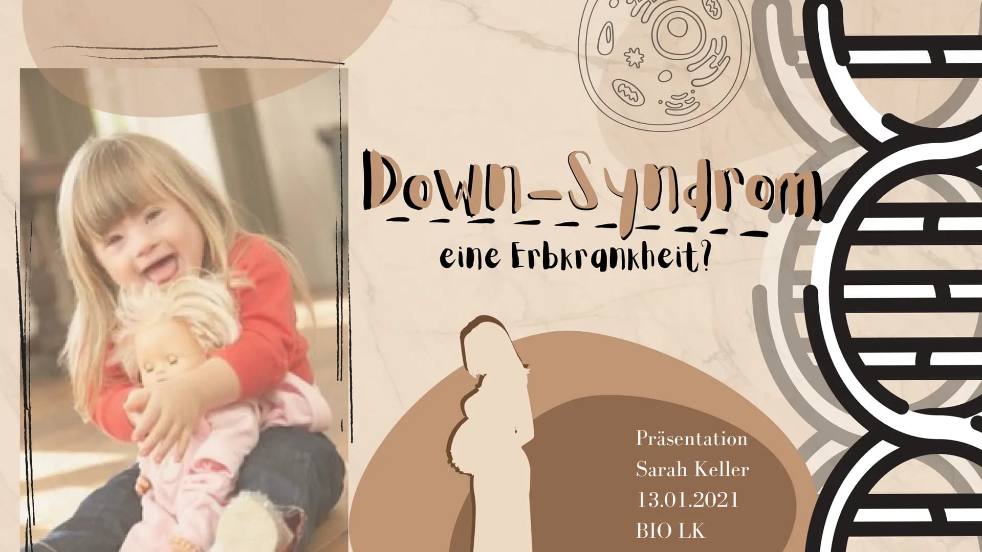 # Down-Syndrom

eine Erbkrankheit?

Präsentation
Sarah Keller
13.01.2021
BIO LK Gliederung

Was ist ein Syndrom?
Down-Syndrom- Ein Syndrom?
