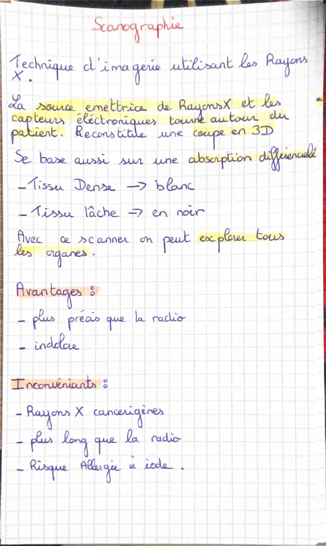 # Radiographie

Technique d'imagevé médicale utilisant
les Rayons X

Les Rayons X vont être absabés et ceux
qui ressortent frappent un recep