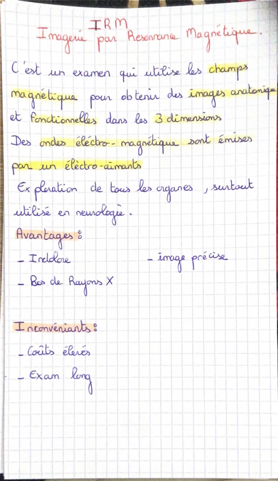 # Radiographie

Technique d'imagevé médicale utilisant
les Rayons X

Les Rayons X vont être absabés et ceux
qui ressortent frappent un recep
