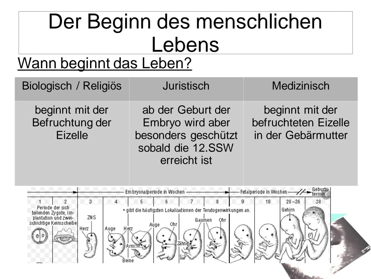 # Schwangerschaftsabbruch

GYNÄKOLOGEN

ZEITDRUCK

VERURTEILUNG

BERATUNGSPFLICHT # Schwangerschaftsabbruch

Gliederung:

*   Allgemein
*   