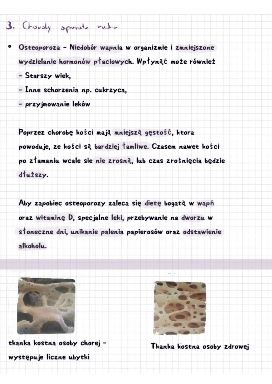 # HIGIENA I CHOROBY APARATU RUCHU
1. Postawa cinta
Kręgosłup ma swoje maturalne krzywizny.
Zaliczają się do nich
Lordoza
Kifoza
Lordoza