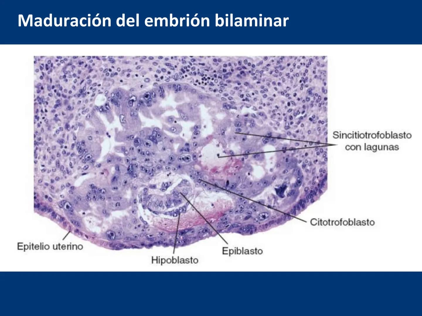 UNIVERSIDAD WESTHILL
VESTIGIA NULLA RETRORSUM
Embriología Humana I
Dr. Alejandro Farrera Hdz.
Desarrollo de
Placenta # Estructuras placent