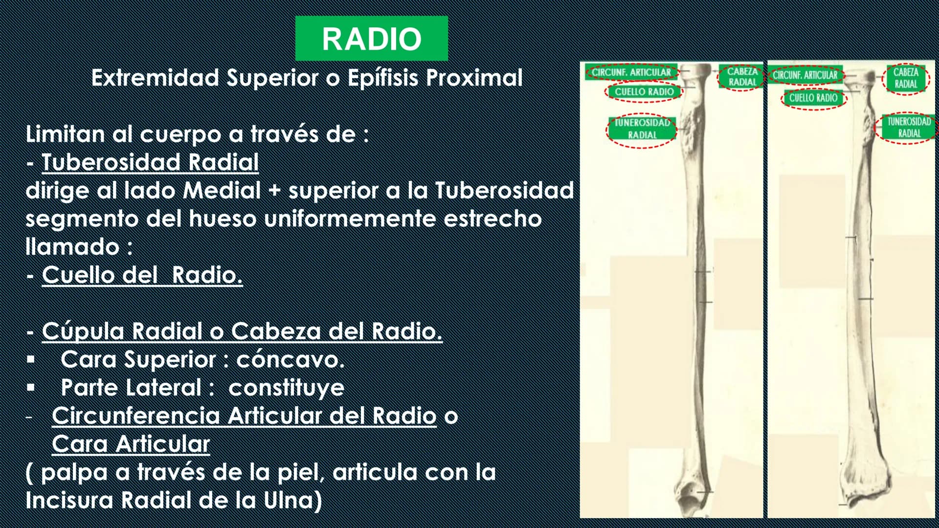 # HUESOS DEL MIEMBRO
SUPERIOR
Dr. Orsini Flores Monterrey
Medico-Cirujano
Ortopedista- Traumatólogo
UCN
Universided Central de Nicaragua