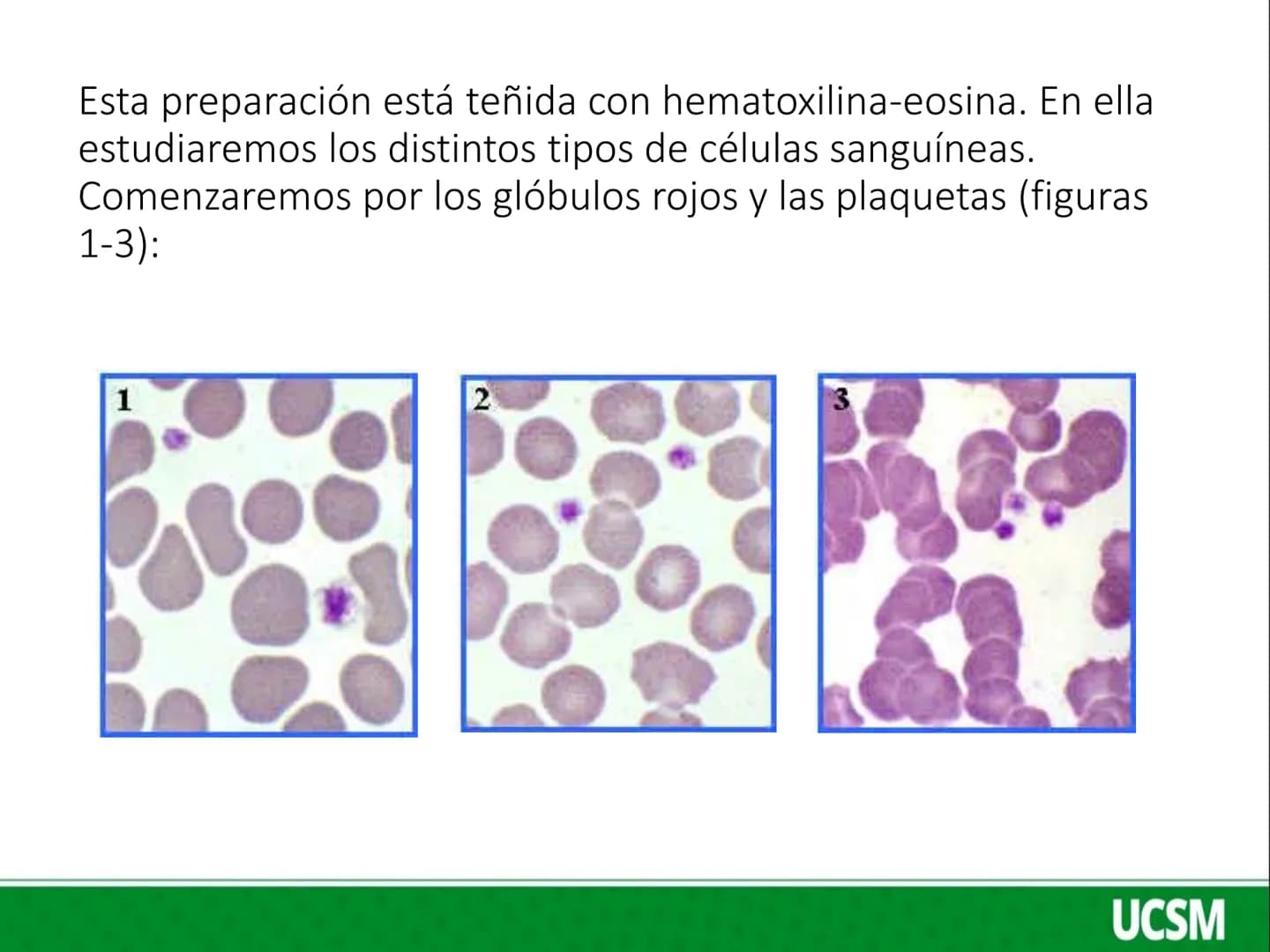 Universidad Católica
de Santa María
FISIOLOGIA DE LA SANGRE 2
Mtro: FERNANDO TORRES VELA LEUCOCITOS
• Son células de color blanco (glóbul