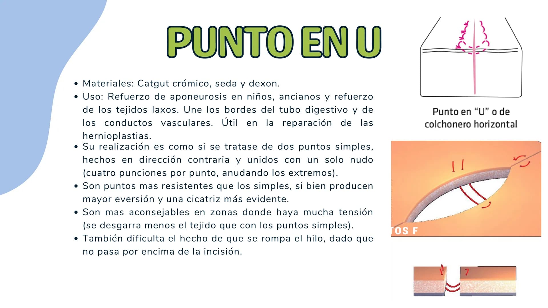 # TÉCNICAS QUIRÚRGICAS
# PUNTOS DE SUTURA
MARÍA FERNANDA LANDEROS RODRÍGUEZ # NORMA OFICIAL MEXICANA
# NOM-067-SSA1-1993
ESTABLECE LAS ES