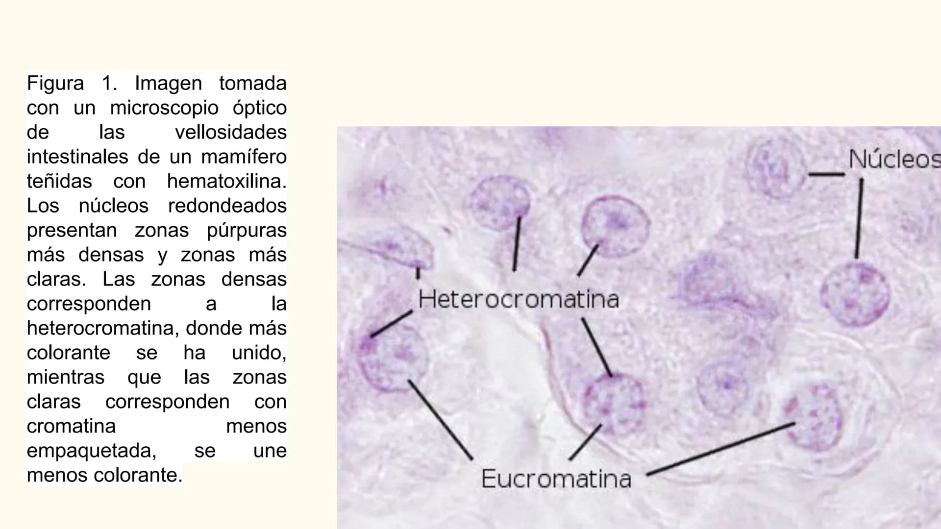 CITOLOGÍA II
Núcleo
Eucariota
Nucleolo
Mitocondria
Ribosomas
Procariota
Nucleoide
Cápsula
Flagelo
Pared celular
Membrana plasmática # E
