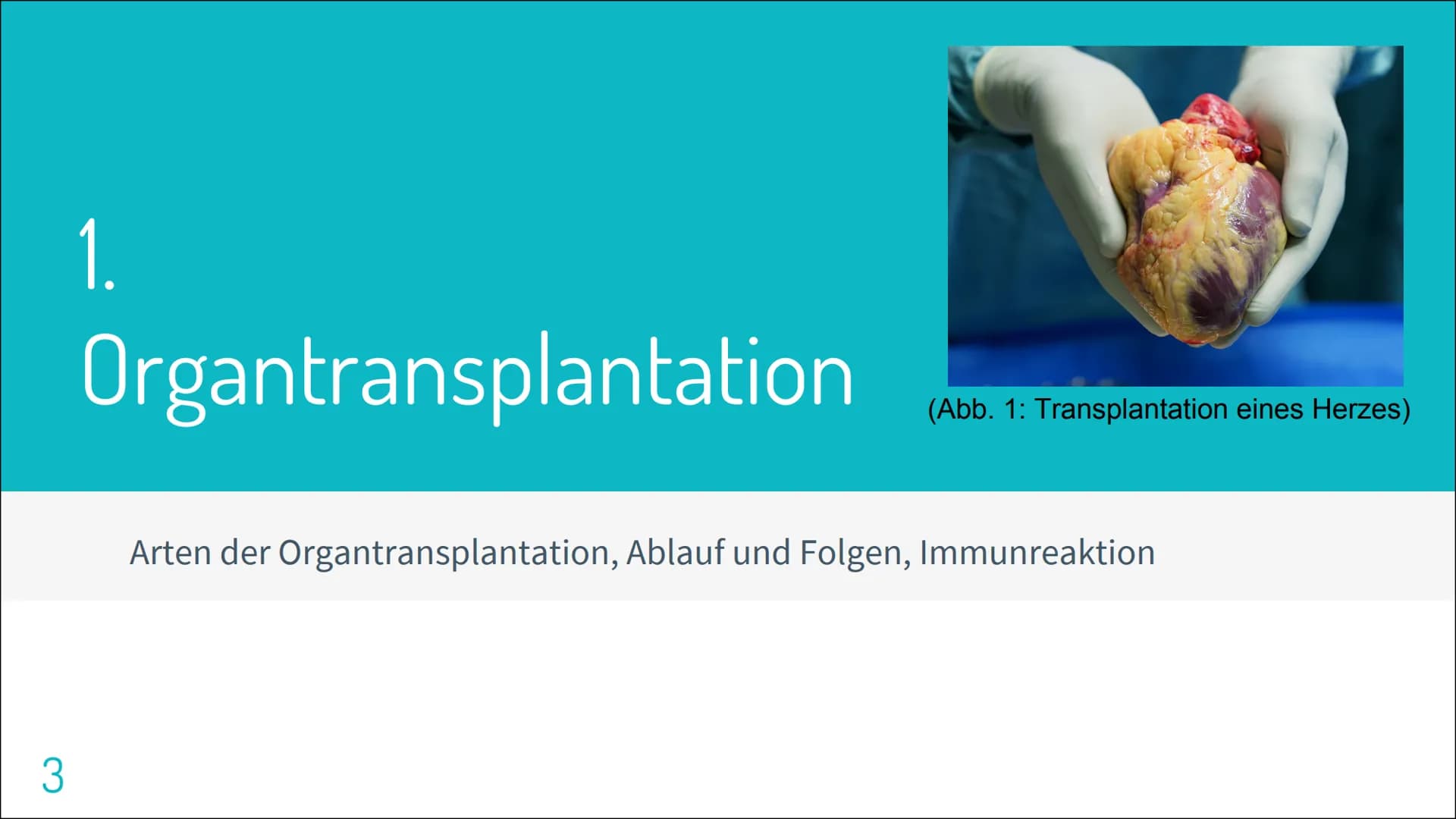 # ORGAN TRANSPLANTATION 2
# Gliederung
▷ Organtransplantation
* Arten der Organtransplantation
* Ablauf und Folgen
* Immunreaktion