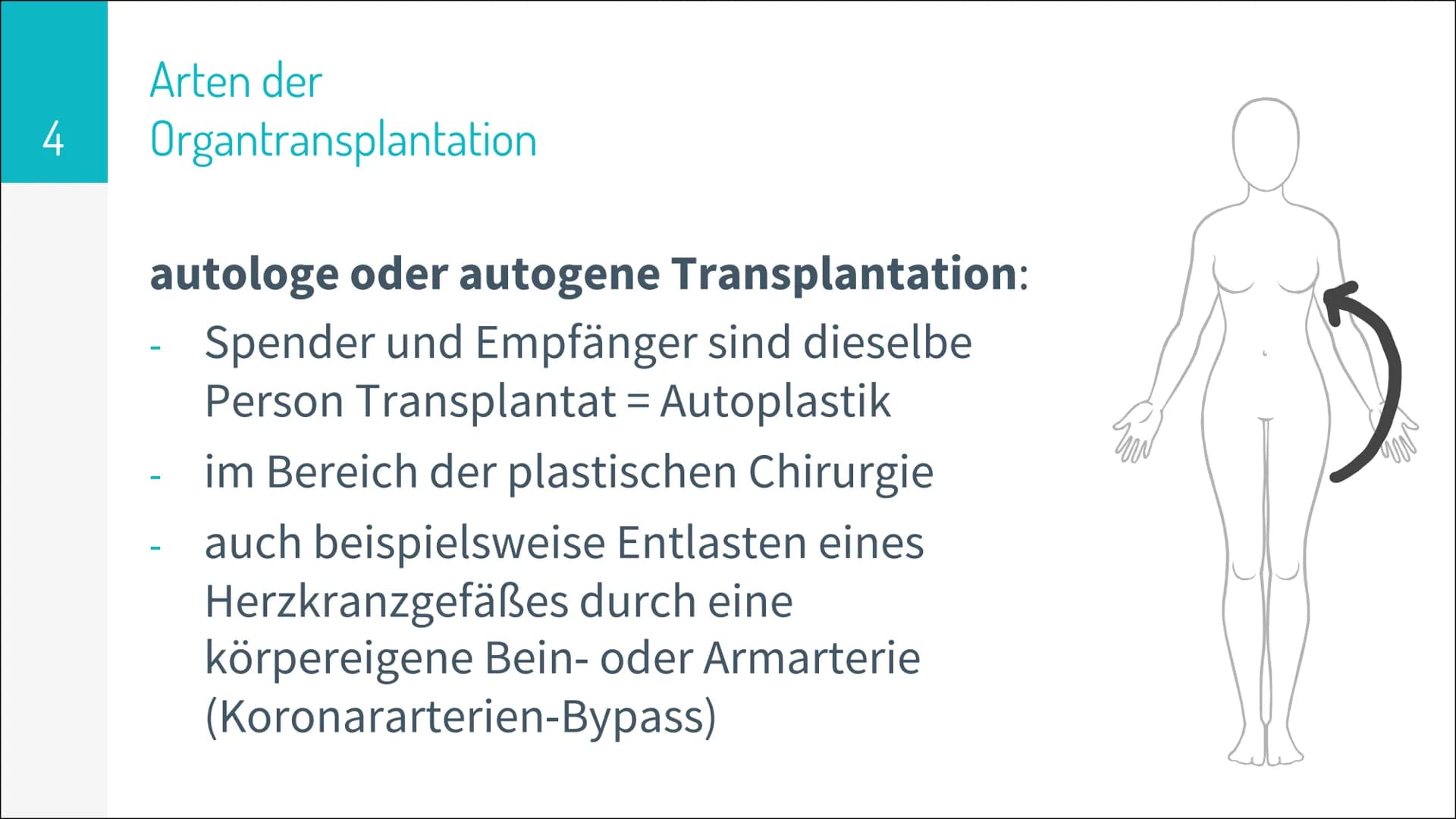 # ORGAN TRANSPLANTATION 2
# Gliederung
▷ Organtransplantation
* Arten der Organtransplantation
* Ablauf und Folgen
* Immunreaktion