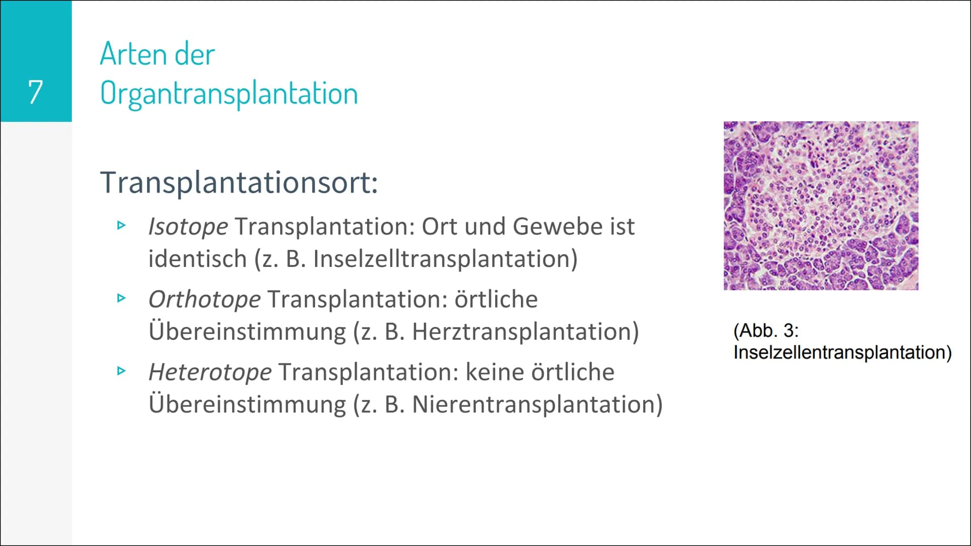 # ORGAN TRANSPLANTATION 2
# Gliederung
▷ Organtransplantation
* Arten der Organtransplantation
* Ablauf und Folgen
* Immunreaktion