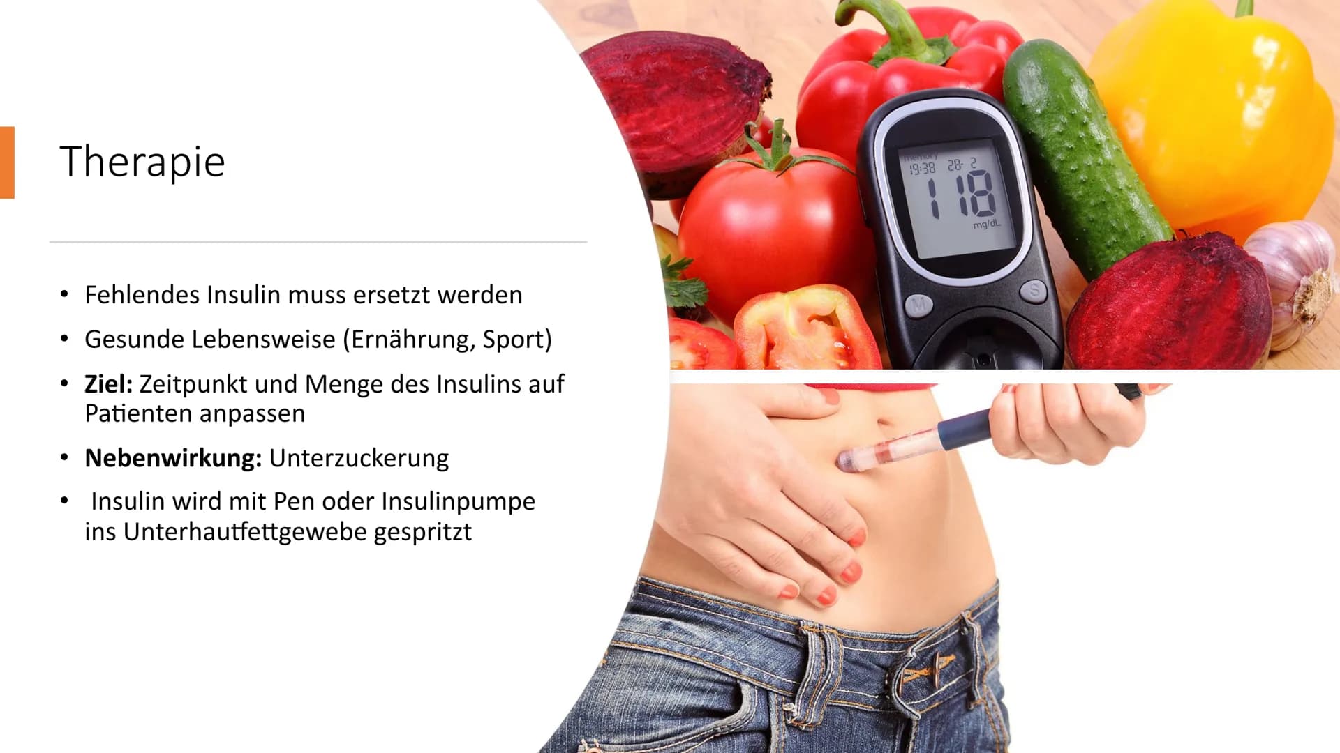 # Diabetes mellitus
Von Nikolas Schmieg Was ist Diabetes
mellitus?
• griech. διαβαίνειν= durchfließen
lat. mellitus= honigsüß
• Hauptmer