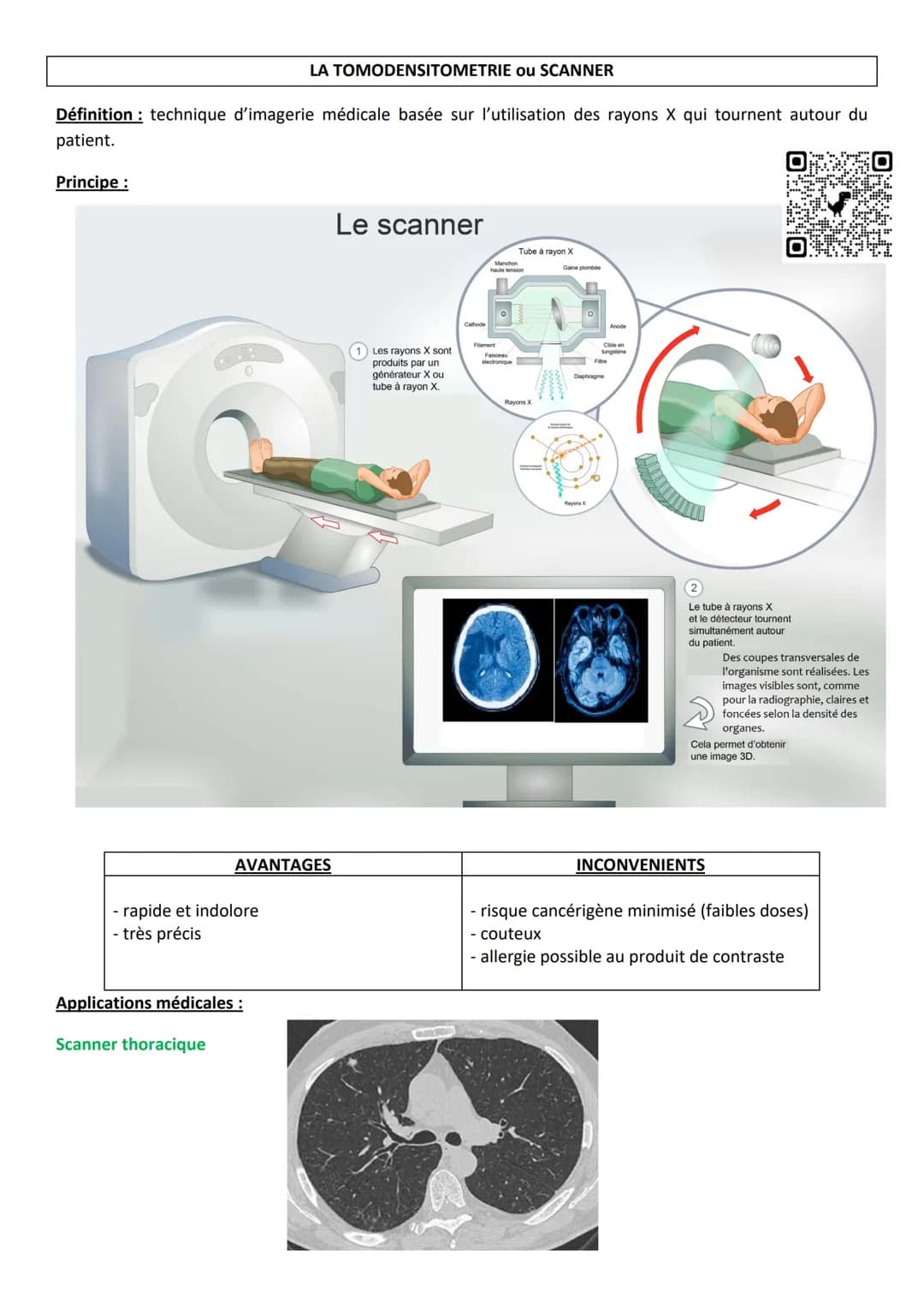 LA TOMODENSITOMETRIE ou SCANNER
Définition: technique d'imagerie médicale basée sur l'utilisation des rayons X qui tournent autour du
patie