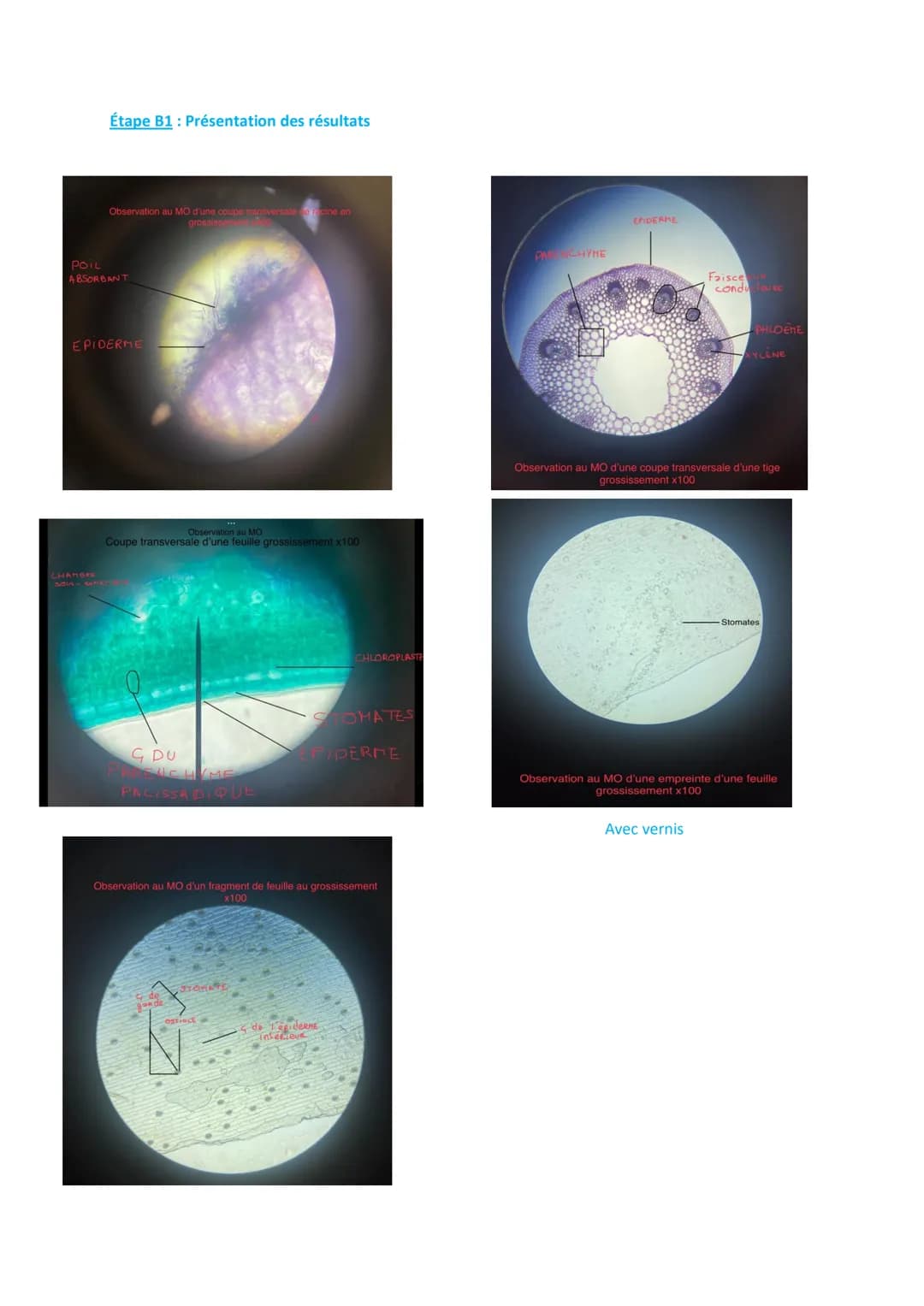 Exemple de TP sur l'observation au microscope de racine, de feuille et de tige avec la
réalisation d'une empreinte de feuille d'épiderme de