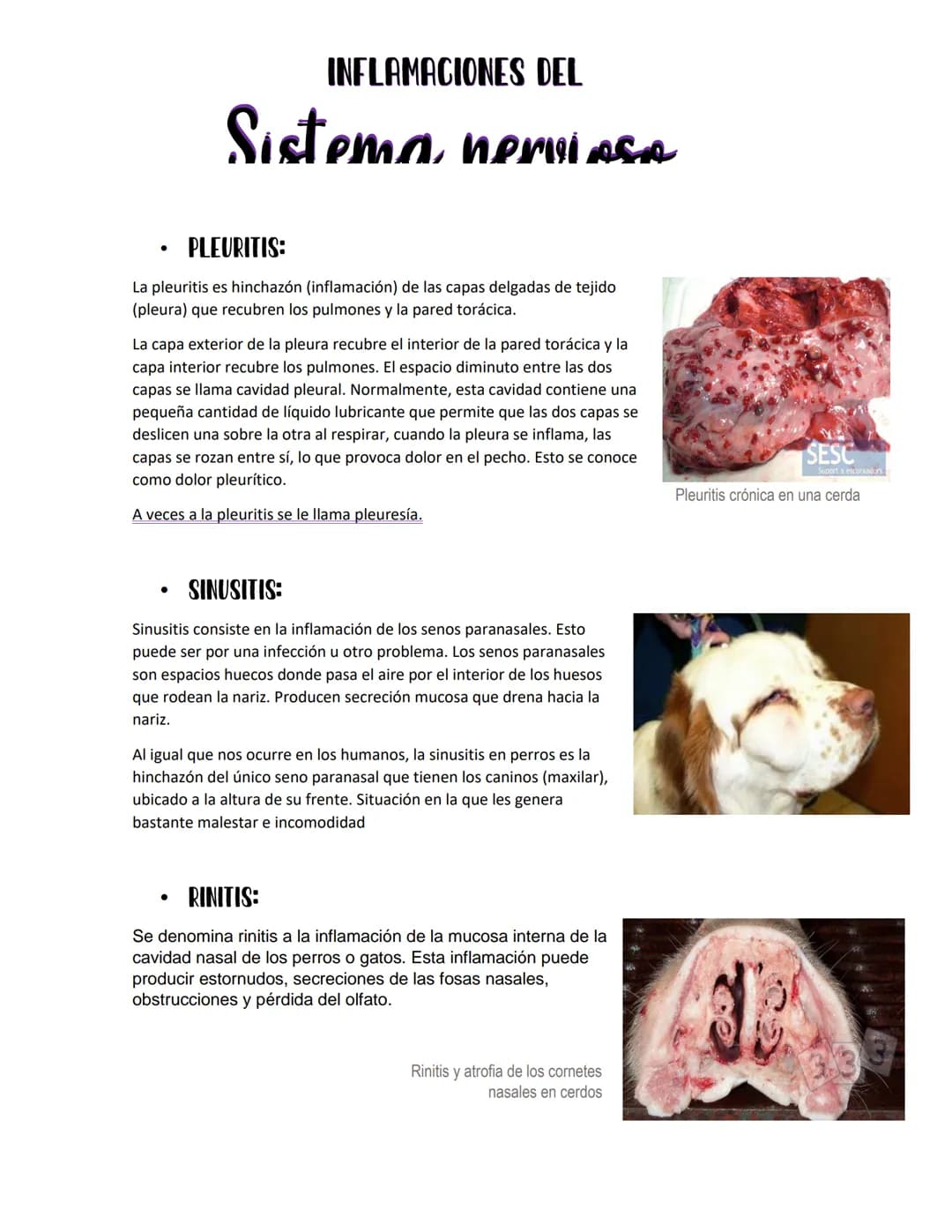 # INFLAMACIONES DEL
Sistema nerviمعم
- PLEURITIS:
La pleuritis es hinchazón (inflamación) de las capas delgadas de tejido
(pleura) que rec