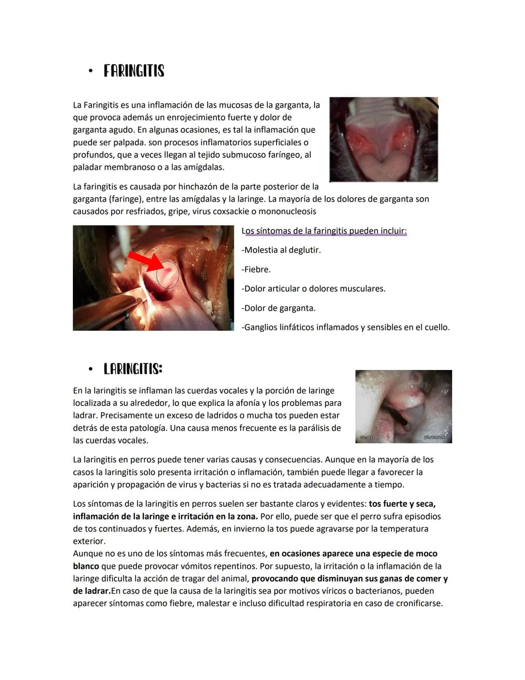 # INFLAMACIONES DEL
Sistema nerviمعم
- PLEURITIS:
La pleuritis es hinchazón (inflamación) de las capas delgadas de tejido
(pleura) que rec